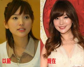 明星整形八卦,揭秘娱乐圈美丽背后的秘密