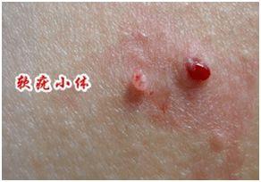 身上起水猴子图片,探寻身世之谜的神秘传说